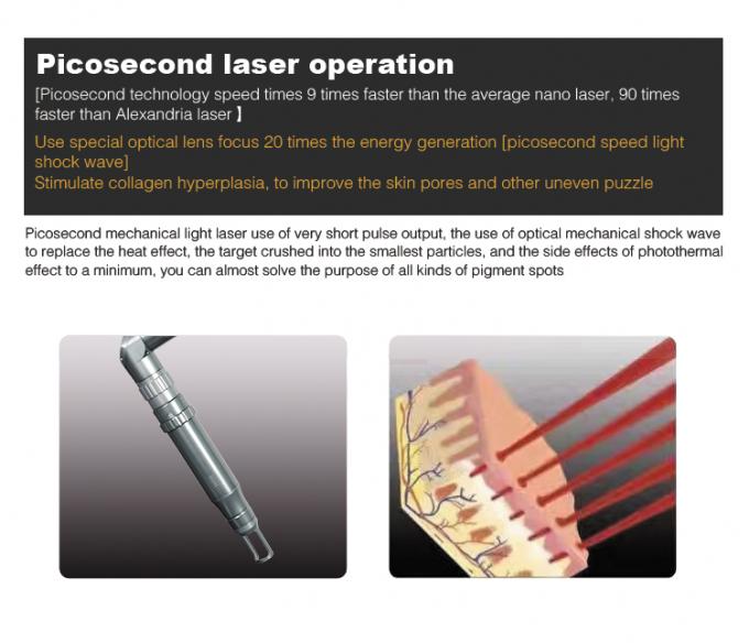 1064nm Picosecond Laser Maschine PICO Einfache Bedienung Pico Pulse Maschine 3